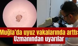 Muğla’da uyuz vakaları arttı: Uzmanından uyarılar