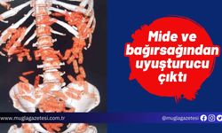 Mide ve bağırsağından uyuşturucu çıktı