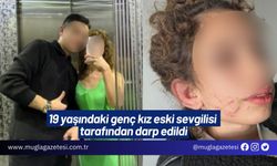 19 yaşındaki genç kız eski sevgilisi tarafından darp edildi