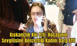 Kıskançlık Kör Etti: Kocasının Sevgilisine Benzettiği Kadını Darp Etti