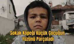 Sokak Köpeği Küçük Çocuğun Yüzünü Parçaladı