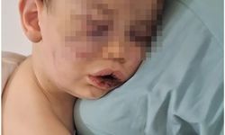 2 Yaşındaki Bebek Yoğun Bakımda: Anne ve Erkek Arkadaşı Gözaltında