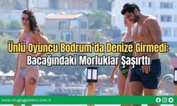 Ünlü Oyuncu Bodrum’da Denize Girmedi: Bacağındaki Morluklar Şaşırttı