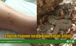 Engerek Yılanının Isırdığı Kadın Tedavi Altında