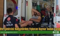 Oto Tamircisi Radyatörden Fışkıran Kaynar Sudan Yandı