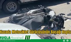 Kazada Motosiklet Sürücüsünün Bacağı Koptu