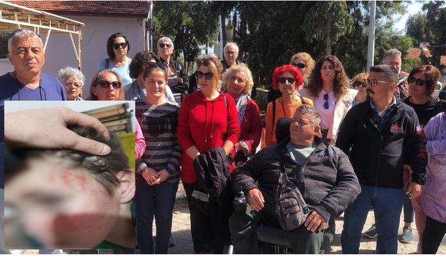Datça'da Otizmli Çocuğa Darp: Şüpheliye Hapis Cezası