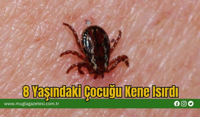8 Yaşındaki Çocuğu Kene Isırdı