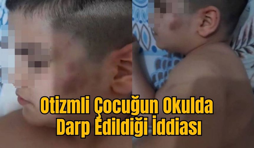 Otizmli Çocuğun Okulda Darp Edildiği İddiası