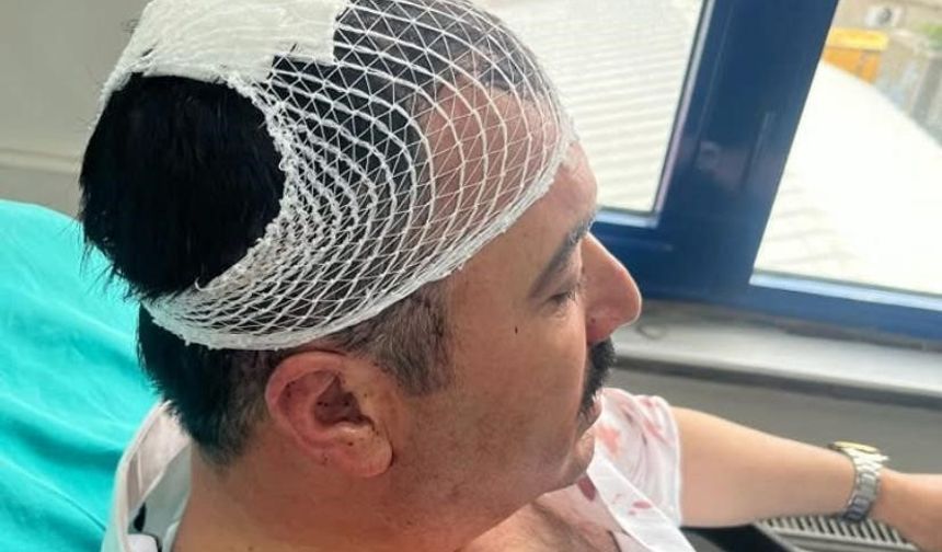 Belediye Başkan Yardımcısı Şekerlikle Darp Edildi