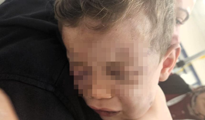 2 Yaşındaki Bebek Annesinin Sevgilisi Tarafından Darbedildi