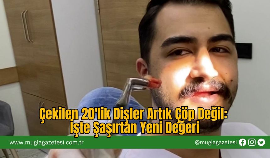 Çekilen 20'lik Dişler Artık Çöp Değil: İşte Şaşırtan Yeni Değeri